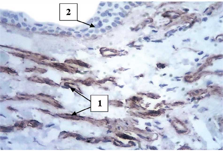 Экспрессия МКАТ против коллагена IV типа (1) в грубоволокнистой соединительной ткани