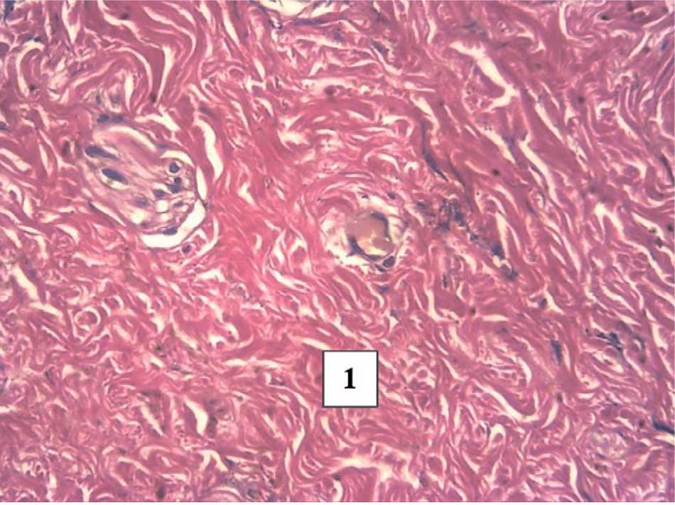 Грубоволокнистая соединительная ткань